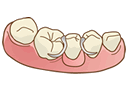 入れ歯について